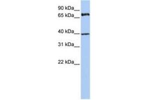 Image no. 1 for anti-Membrane Protein, Palmitoylated 5 (MAGUK P55 Subfamily Member 5) (MPP5) (AA 36-85) antibody (ABIN6740785) (MPP5 antibody  (AA 36-85))