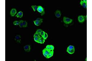 Immunofluorescent analysis of MCF-7 cells using ABIN7143981 at dilution of 1:100 and Alexa Fluor 488-congugated AffiniPure Goat Anti-Rabbit IgG(H+L) (SCNN1G antibody  (AA 90-350))