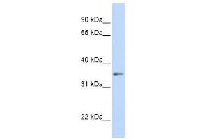 GNB1 antibody used at 1 ug/ml to detect target protein.