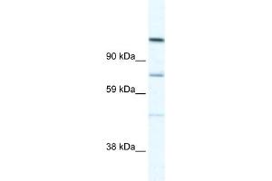 WB Suggested Anti-D930005D10RIK Antibody Titration:  5. (Radil antibody  (C-Term))