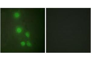 Immunofluorescence analysis of HuvEc cells, using ACTL6A Antibody. (BAF53A antibody  (AA 201-250))