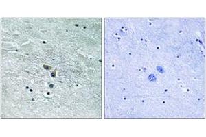 Immunohistochemistry analysis of paraffin-embedded human brain tissue, using MAP3K8 (Ab-400) Antibody.