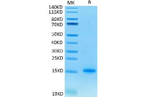 Human CD3E on Tris-Bis PAGE under reduced condition.