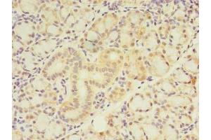 Immunohistochemistry of paraffin-embedded human pancreatic tissue using ABIN7175970 at dilution of 1:100 (ZNF238 antibody  (AA 62-364))