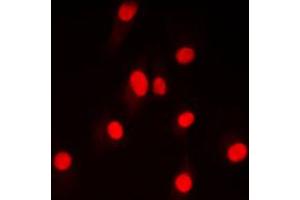 Immunofluorescent analysis of DNA Ligase 4 staining in HepG2 cells. (LIG4 antibody  (Center))