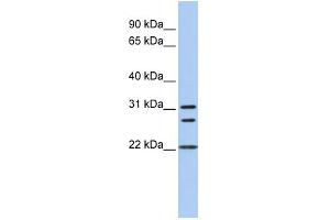 WB Suggested Anti-CNN1 Antibody Titration:  0. (CNN1 antibody  (N-Term))