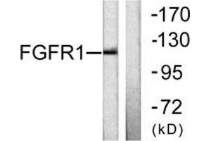 Western blot analysis of extracts from 293 cells, using FGFR1 (Ab-654) Antibody. (FGFR1 antibody  (AA 626-675))