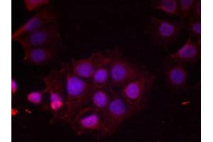 Immunofluorescence staining of methanol-fixed MCF cells using Estrogen Receptor-a(Phospho-Ser118) Antibody. (Estrogen Receptor alpha antibody  (pSer118))