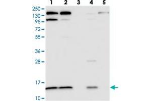 Western blot analysis of Lane 1: RT-4, Lane 2: U-251 MG, Lane 3: Human Plasma, Lane 4: Liver, Lane 5: Tonsil with CMC1 polyclonal antibody .