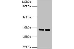 Western blot All lanes: SRM antibody at 2 μg/mL Lane 1: EC109 whole cell lysate Lane 2: 293T whole cell lysate Secondary Goat polyclonal to rabbit IgG at 1/15000 dilution Predicted band size: 34 kDa Observed band size: 34 kDa (Spermidine Synthase antibody  (AA 17-302))