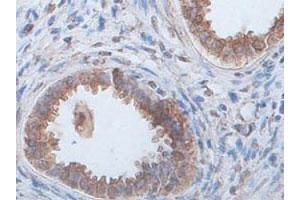 Immunohistochemical staining of formalin-fixed paraffin-embedded human fetal kidney tissue showing cytoplasmic staining with ECH1 polyclonal antibody  at 1 : 100 dilution. (ECH1 antibody  (AA 145-325))