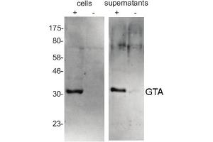 Roseobacter capsulatus cells, pelleted by centrifugation and resuspended in an equial volume of TE buffer and supernatant sample* were separated on  10% SDS-PAGE and blotted 1h to nitrocellulose. (Gene Transfer Agent (GTA) Major Capsid Protein (MCP) (GTA MCP ) antibody)