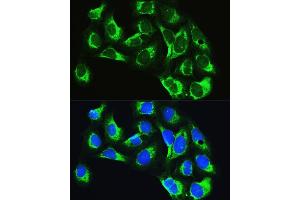 Immunofluorescence analysis of U2OS cells using LARS Rabbit pAb (ABIN7268238) at dilution of 1:100. (LARS antibody  (AA 1-270))