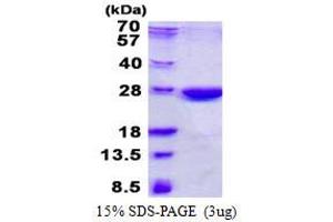 Image no. 1 for Nonhomologous End-Joining Factor 1 (NHEJ1) protein (His tag) (ABIN1098374) (NHEJ1 Protein (His tag))