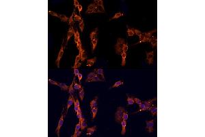 Immunofluorescence analysis of C6 cells using EPS15 Rabbit pAb  at dilution of 1:200 (40x lens).