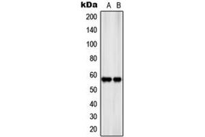 Western blot analysis of SLC22A17 expression in SKNSH (A), rat kidney (B) whole cell lysates.