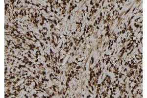 ABIN6277748 at 1/100 staining Human gastric tissue by IHC-P. (MCM5 antibody  (N-Term))