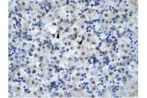 MAPK14 antibody was used for immunohistochemistry at a concentration of 4-8 ug/ml to stain Hepatocytes (arrows) in Human Liver.