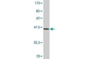 Western Blot detection against Immunogen (47. (ASF1B antibody  (AA 1-202))