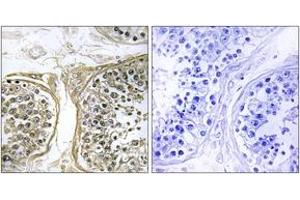 Immunohistochemistry analysis of paraffin-embedded human testis, using Cytochrome P450 2C8 Antibody. (CYP2C8 antibody  (AA 241-290))