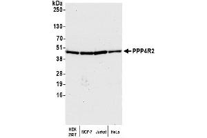 Western Blotting (WB) image for anti-Protein Phosphatase 4, Regulatory Subunit 2 (PPP4R2) (C-Term) antibody (ABIN7453641) (PPP4R2 antibody  (C-Term))