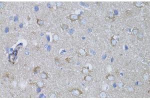Immunohistochemistry of paraffin-embedded Rat brain using MYH10 Polyclonal Antibody at dilution of 1:100 (40x lens).