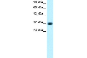 WB Suggested Anti-RAX Antibody Titration:  0.