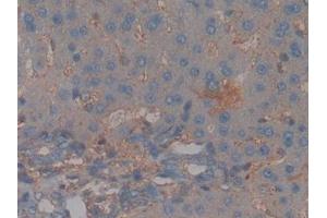 Detection of CFH in Rat Liver Tissue using Polyclonal Antibody to Complement Factor H (CFH) (Complement Factor H antibody  (AA 975-1217))