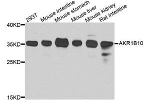 Western blot analysis of extracts of various cell lines, using AKR1B10 antibody. (AKR1B10 antibody  (AA 1-316))