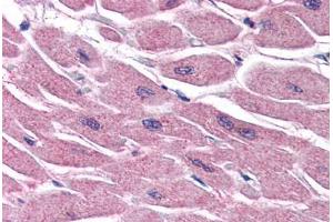 Human Heart (formalin-fixed, paraffin-embedded) stained with STRADB antibody ABIN351469 at 3. (STRADB antibody  (AA 406-418))