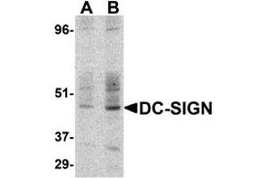 Western Blotting (WB) image for anti-CD209 (CD209) (C-Term) antibody (ABIN1030357) (DC-SIGN/CD209 antibody  (C-Term))
