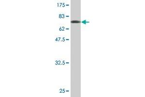 Western Blot detection against Immunogen (64. (IL1RAP antibody  (AA 1-356))