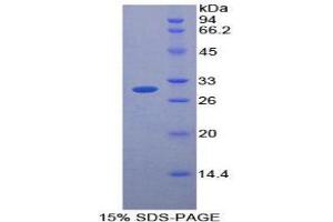 SDS-PAGE (SDS) image for Protease, serine, 12 (Neurotrypsin, Motopsin) (PRSS12) (AA 153-399) protein (His tag) (ABIN1879918)