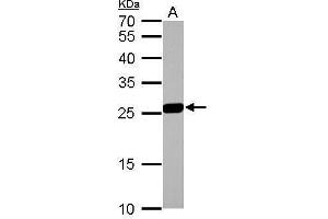 WB Image GSTM1 antibody detects GSTM1 protein by Western blot analysis. (GSTM1 antibody)