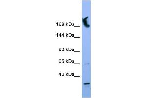 WB Suggested Anti-NUP155 Antibody Titration: 0.