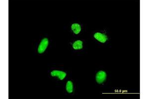 Immunofluorescence of purified MaxPab rabbit antibody to ACTN4 on HeLa cell. (alpha Actinin 4 antibody  (AA 1-911))