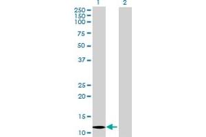 Lane 1: ABCC6 transfected lysate ( 11 KDa) Lane 2: Non-transfected lysate. (ABCC6 293T Cell Transient Overexpression Lysate(Denatured))