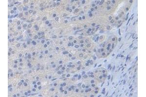 Immunohistochemistry (IHC) image for anti-phosphofructokinase, Muscle (PFKM) (AA 2-390) antibody (ABIN7435508)