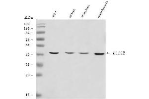 Western blot analysis of OLIG2 using anti-OLIG2 antibody (ABIN7602906).