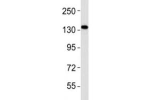 Western Blotting (WB) image for anti-Ephrin Type A Receptor 1 (EPHA1) (AA 453-487) antibody (ABIN3030828)