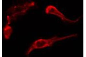ABIN6274208 staining HepG2 cells by IF/ICC. (AKAP5 antibody  (N-Term))