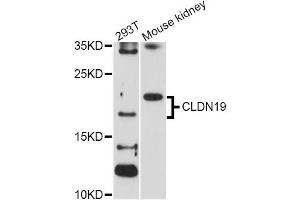 Western blot analysis of extracts of various cell lines, using CLDN19 Antibody (ABIN1871893) at 1:1000 dilution.