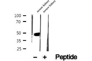 Western blot analysis of extracts of mouse kidney tissue, using DOPA decarboxylase antibody.