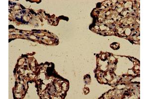 Immunohistochemistry of paraffin-embedded human placenta tissue using ABIN7172843 at dilution of 1:100 (RHOA antibody  (AA 1-191))