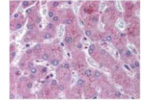 Immunohistochemistry (IHC) image for anti-Notch 2 (NOTCH2) antibody (ABIN104899)