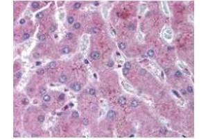 anti-NOTCH 2 antibody was diluted 1:500 to detect NOTCH 2 in human liver tissue. (NOTCH2 antibody  (N-Term))