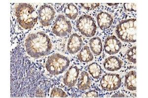 IHC analysis of BubR1/BUB1B using anti-BubR1/BUB1B antibody (ABIN7600961). (BUB1B antibody  (AA 26-448))
