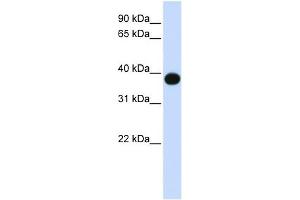 DEGS1 antibody used at 1 ug/ml to detect target protein. (DEGS1 antibody)