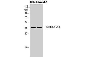 Western Blotting (WB) image for anti-Jun B Proto-Oncogene (JUNB) (Ser664) antibody (ABIN3185273)