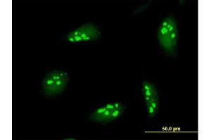 Immunofluorescence of purified MaxPab antibody to NOL7 on HeLa cell. (NOL7 antibody  (AA 1-257))